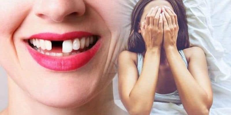 Nằm mơ thấy bản thân bị rụng răng ở hàm trên