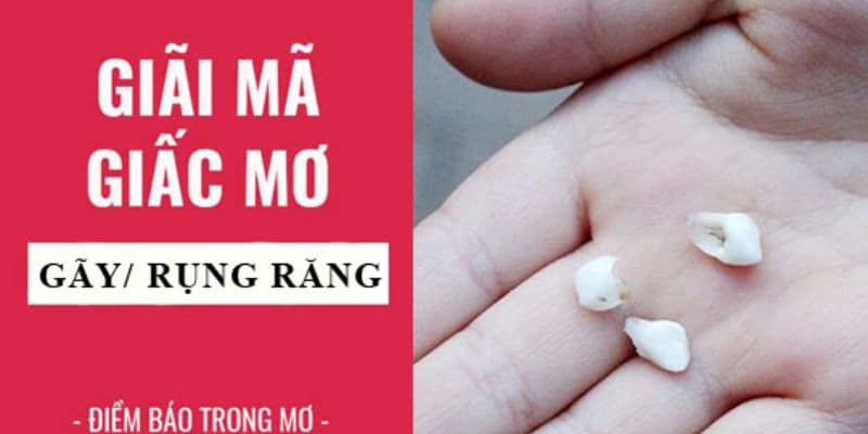 Bạn nằm mơ thấy răng rụng nhưng bị chảy nhiều máu