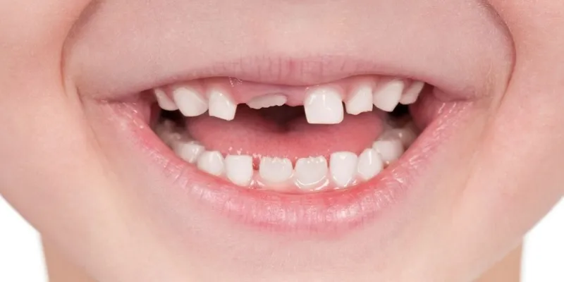 Nằm mơ thấy rụng răng nhưng không có máu