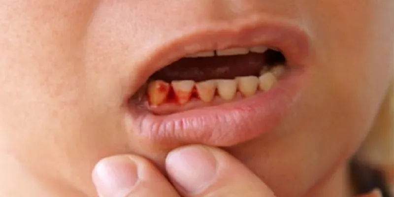 Mơ thấy máu chảy không ngừng